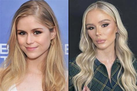 erin.moriarty plastic surgery|The Boys Erin Moriarty fires back at Megyn Kellys plastic。